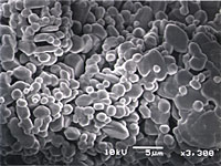 Picture:Aluminum oxide