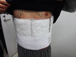 体に隠ぺい工作した覚せい剤 体に隠ぺい工作した覚せい剤